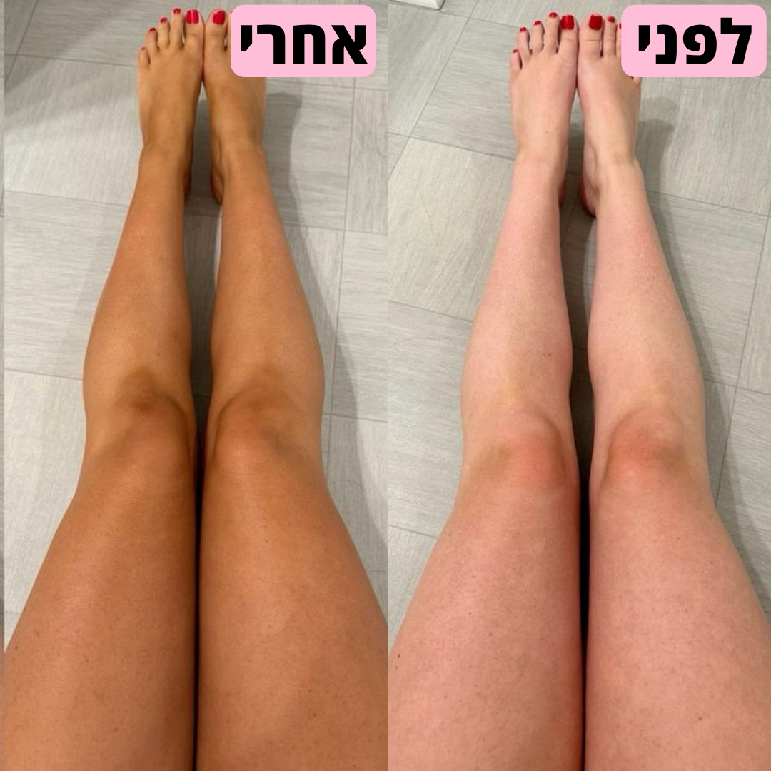 VelvetaGlove™ - כפפת פילינג