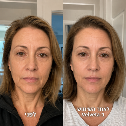 Velveta Skin Renewal™  מארז אנטי אייג׳ינג מקצועי