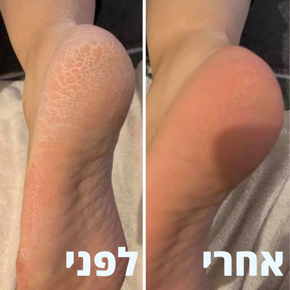 מארז פדיקור של ולוטה