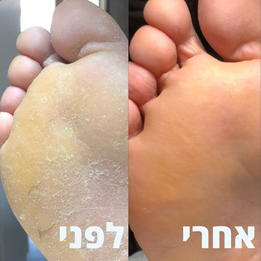 מארז פדיקור של ולוטה