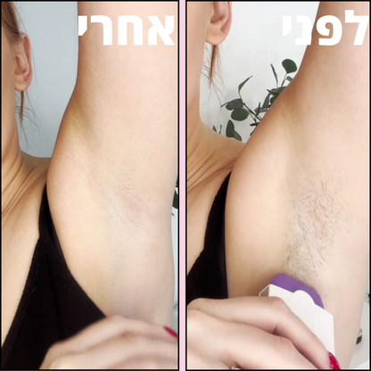 VelvetaSkin™ - מכשיר להסרת שיער