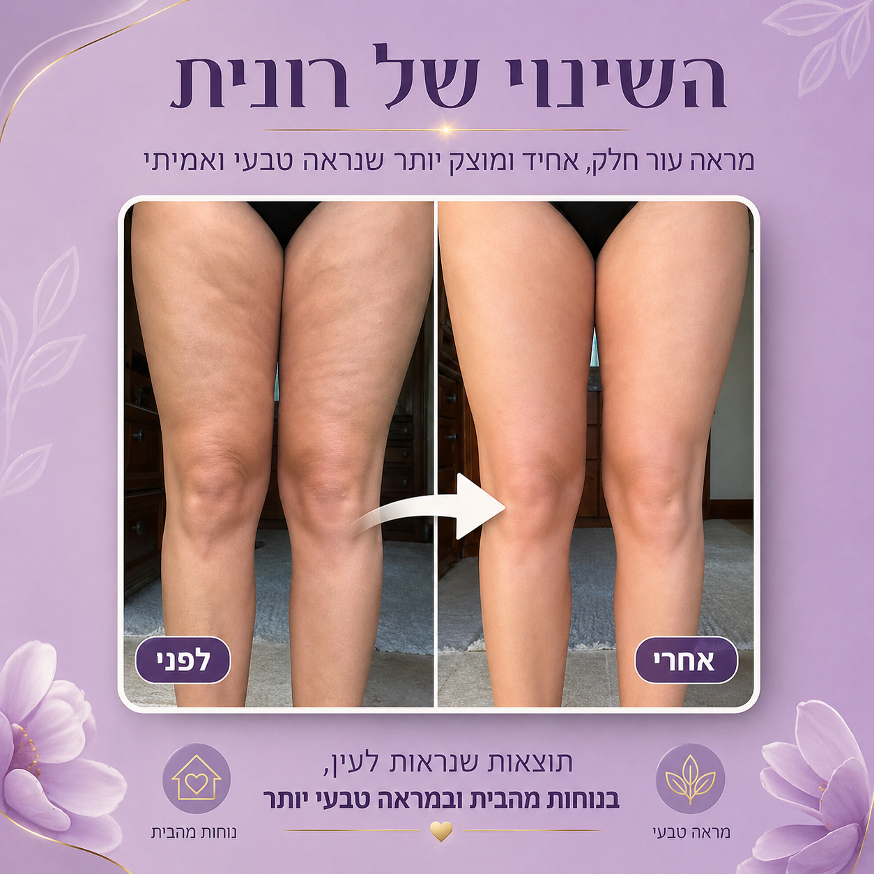 ה- LuxSkin™  - מכשיר להעלמת צלוליטיס