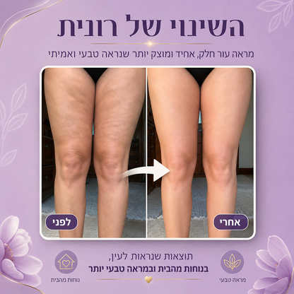 ה- LuxSkin™  - מכשיר להעלמת צלוליטיס