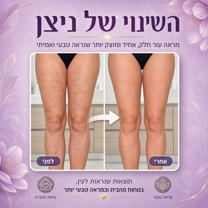 ה- LuxSkin™  - מכשיר להעלמת צלוליטיס