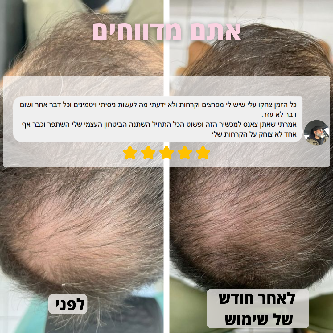 מסרק לעיסוי הקרקפת - ™VelvetaReGrow