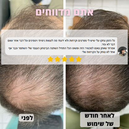 מסרק לעיסוי הקרקפת - ™VelvetaReGrow