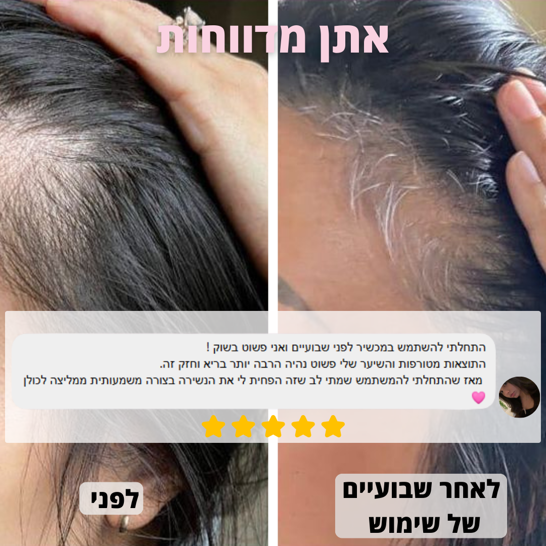 מסרק לעיסוי הקרקפת - ™VelvetaReGrow